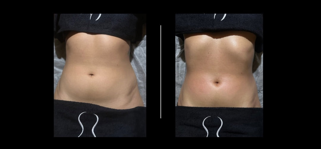 Sculptura Cleanse