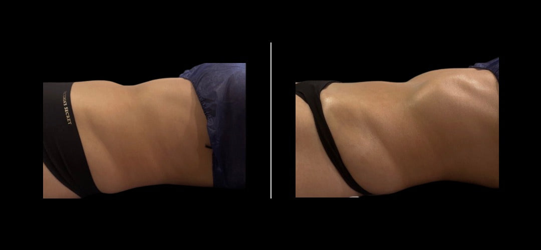Sculptura Cleanse