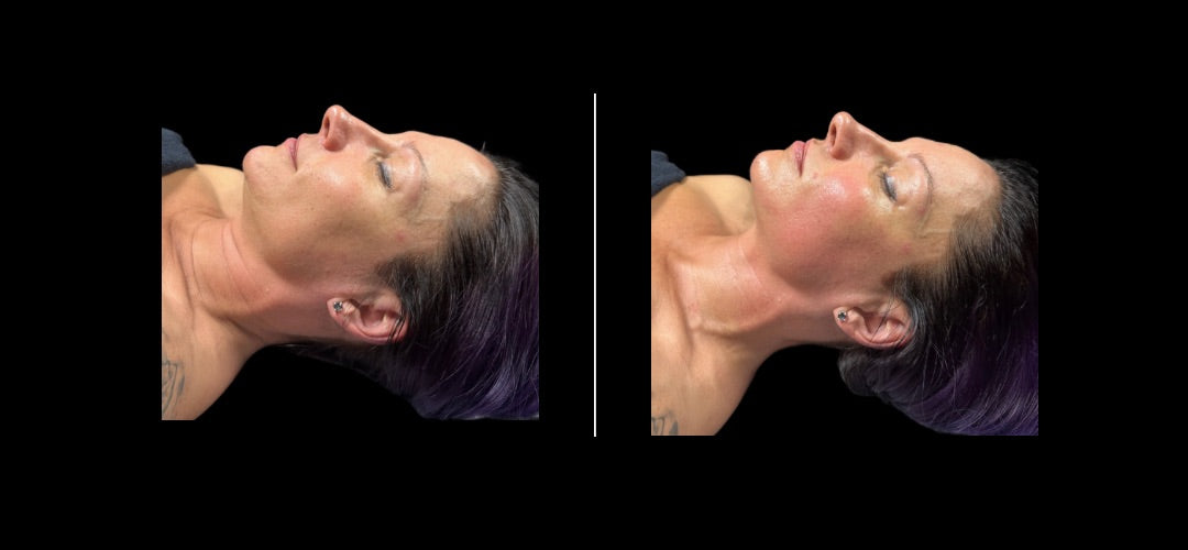 Sculptura Face Contour